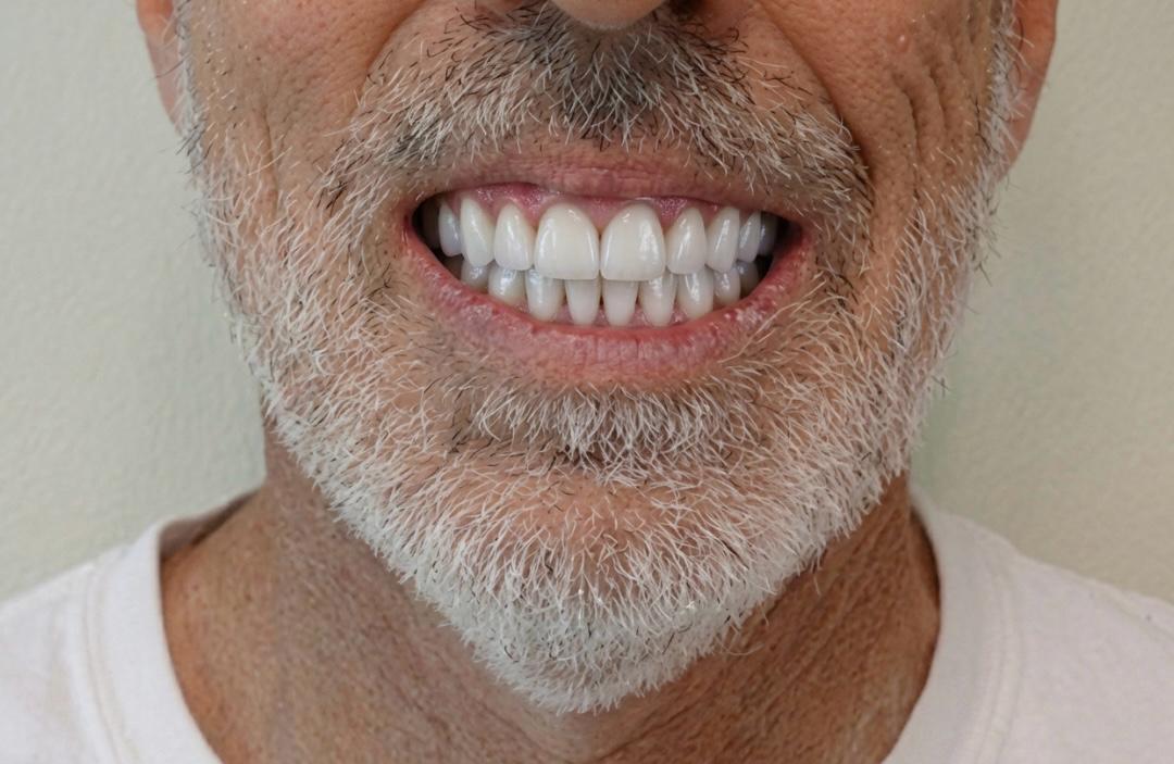 After Treatment